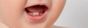 Leia mais sobre o artigo Cuidados dentários para Bebes